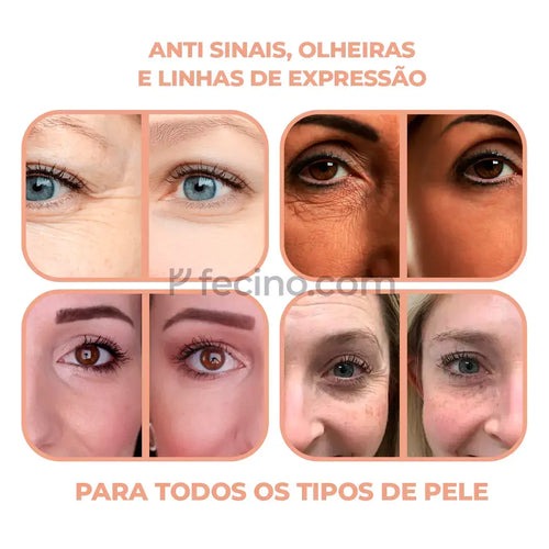 Derol® - Hidratante Multi Bálsamo Anti Sinais, Olheiras e Linhas de Expressão (Compre 1, Leve 2)